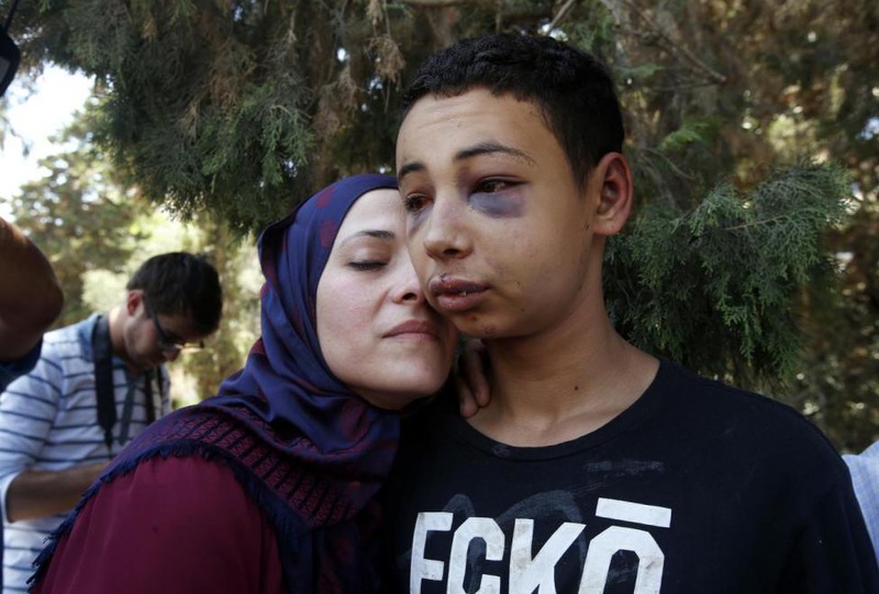 27 Ronen Zvulun. Tariq Khdeir is greeted by his mother after being released from jail in Jerusalem, July 6, 2014.