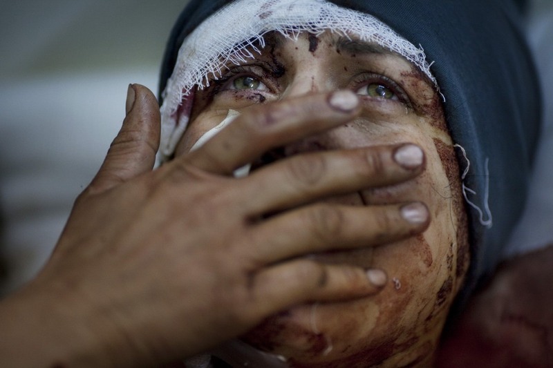 «Аида». Фотограф - Родриго Абд (Аргентина). 
1 место в категории «Основные новости». На фото Аида плачет в больнице, куда попала с тяжелыми ранениями после обстрела сирийской армии, в зону которого попал ее дом. Ее муж и двое детей получили смертельные ранения.