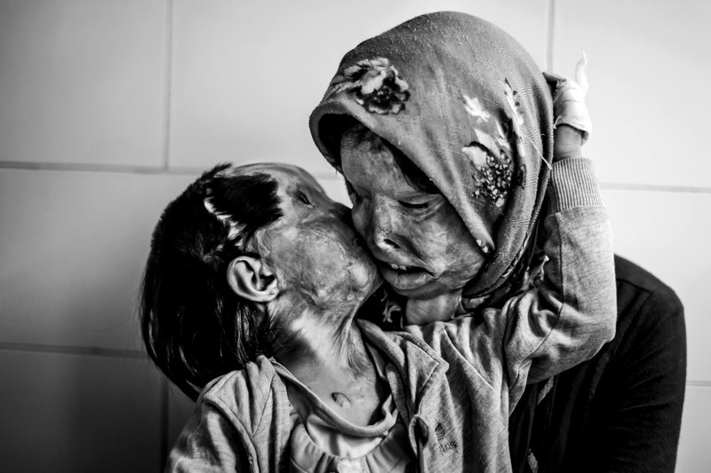 «Жертвы принудительной любви». Фотограф - Ebrahim Noroozi (Иран).Фото из серии.
