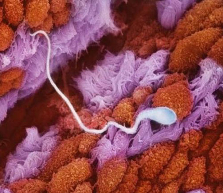 1 Сперматозоид в маточной трубе движется навстречу яйцеклетке.