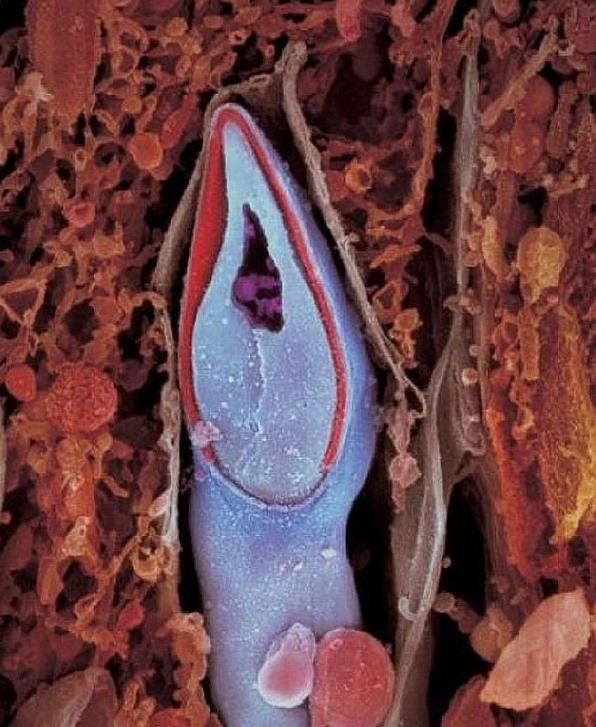 3 Сперматозоид в разрезе. В головке содержится весь генетический материал