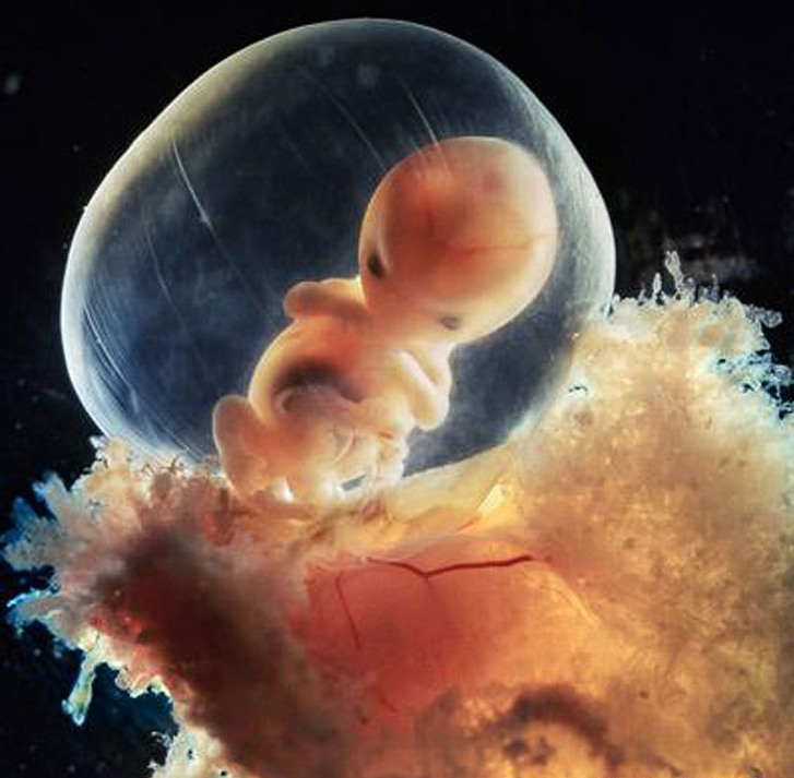 9 40 дней. Наружные клетки зародыша срослись с рыхлой поверхностью матки и образуют плаценту.