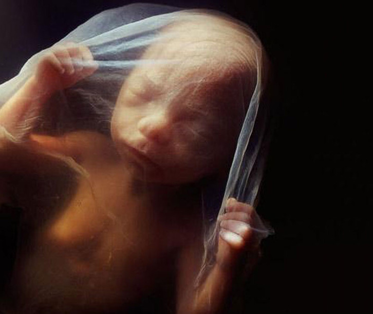 13 18 недель. Зародыш может воспринимать звуки из внешнего мира.
