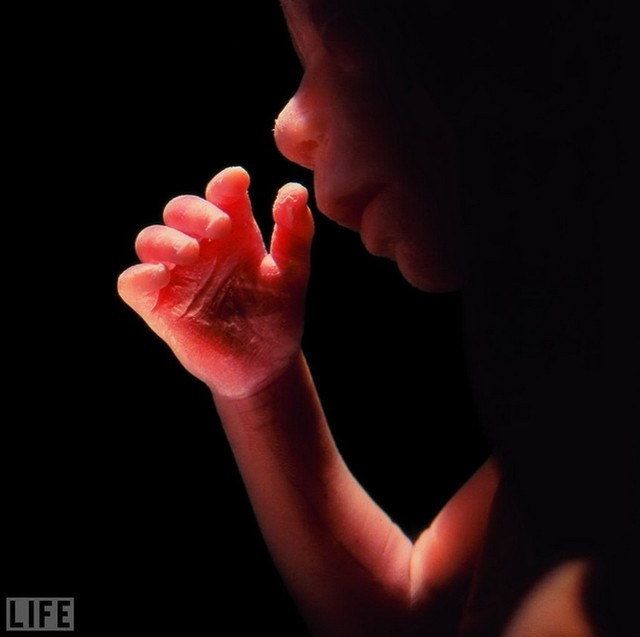 1965. Первый в истории снимок ребенка в утробе матери.